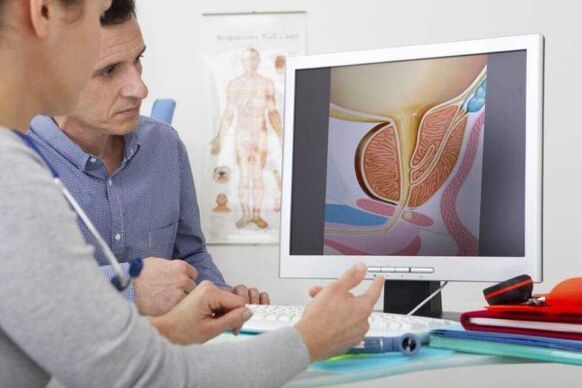 the doctor consults with the patient about the problem of prostatitis