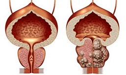 A healthy and have a healthy prostate