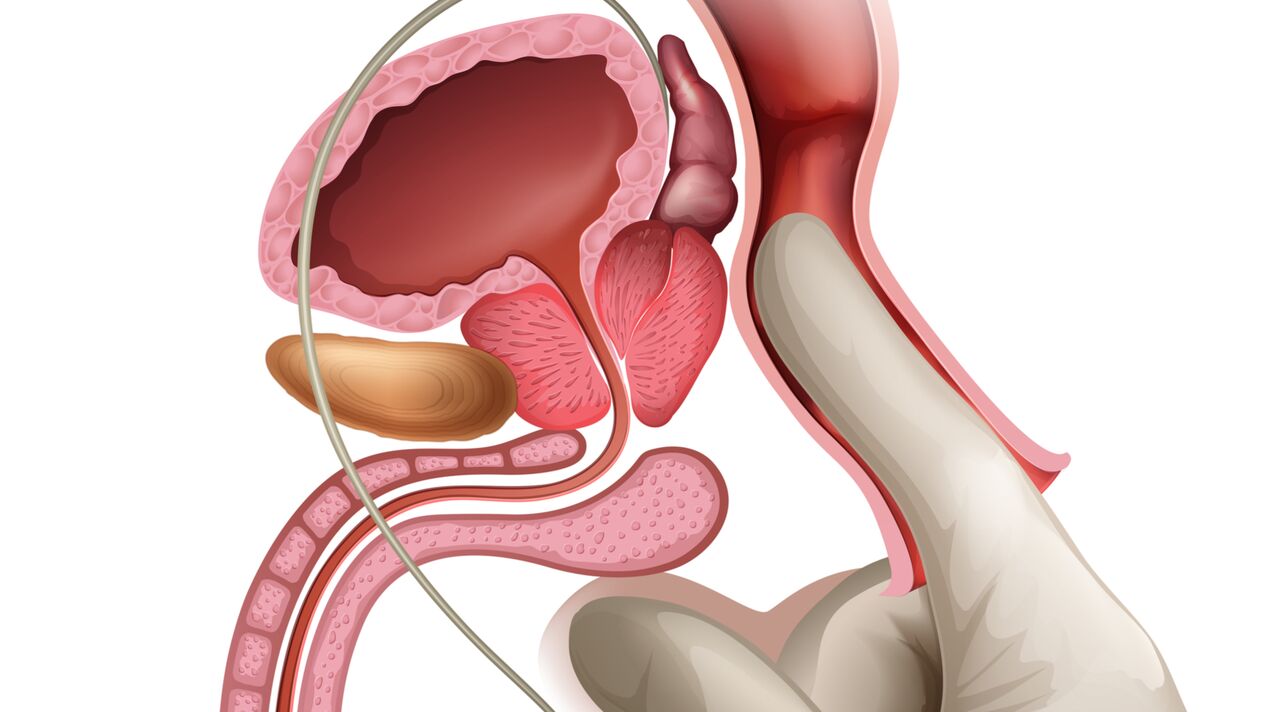 Prostate massage is an effective way to treat congestive prostatitis
