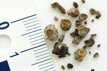 stone